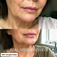 BIO-COLLAGEN PDRN PLUMPING STICK