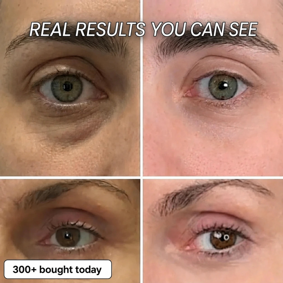 BIO-COLLAGEN PDRN PLUMPING STICK