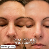 BIO-COLLAGEN PDRN PLUMPING STICK