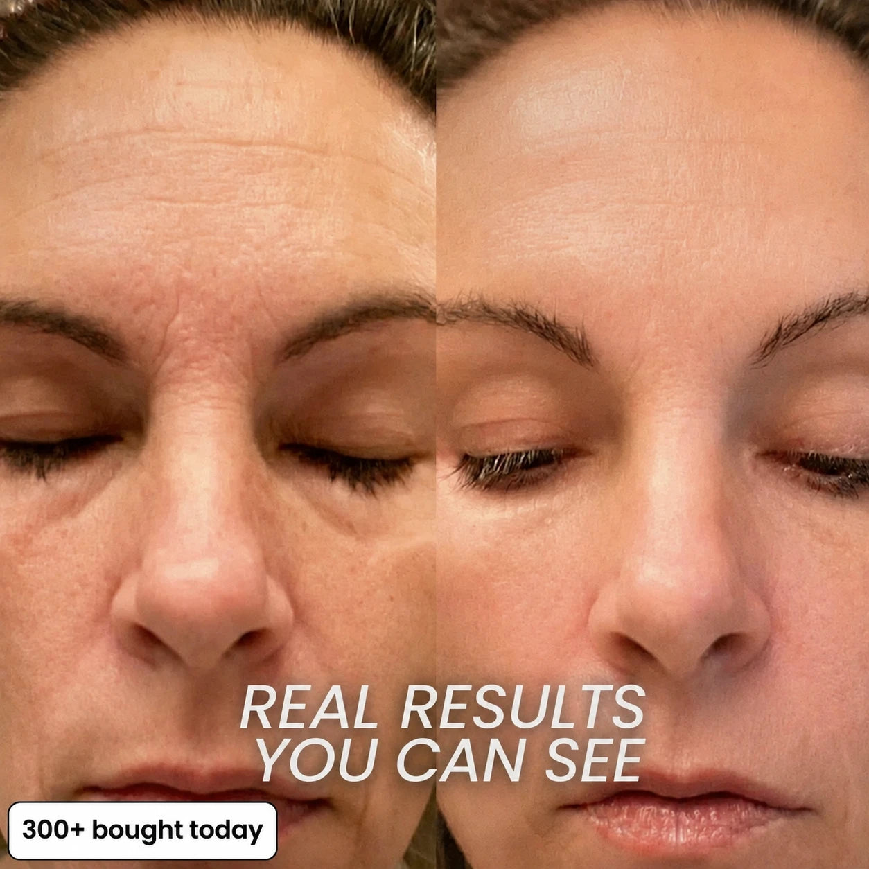 BIO-COLLAGEN PDRN PLUMPING STICK