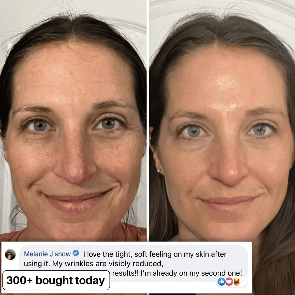 BIO-COLLAGEN PDRN PLUMPING STICK