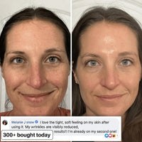 BIO-COLLAGEN PDRN PLUMPING STICK