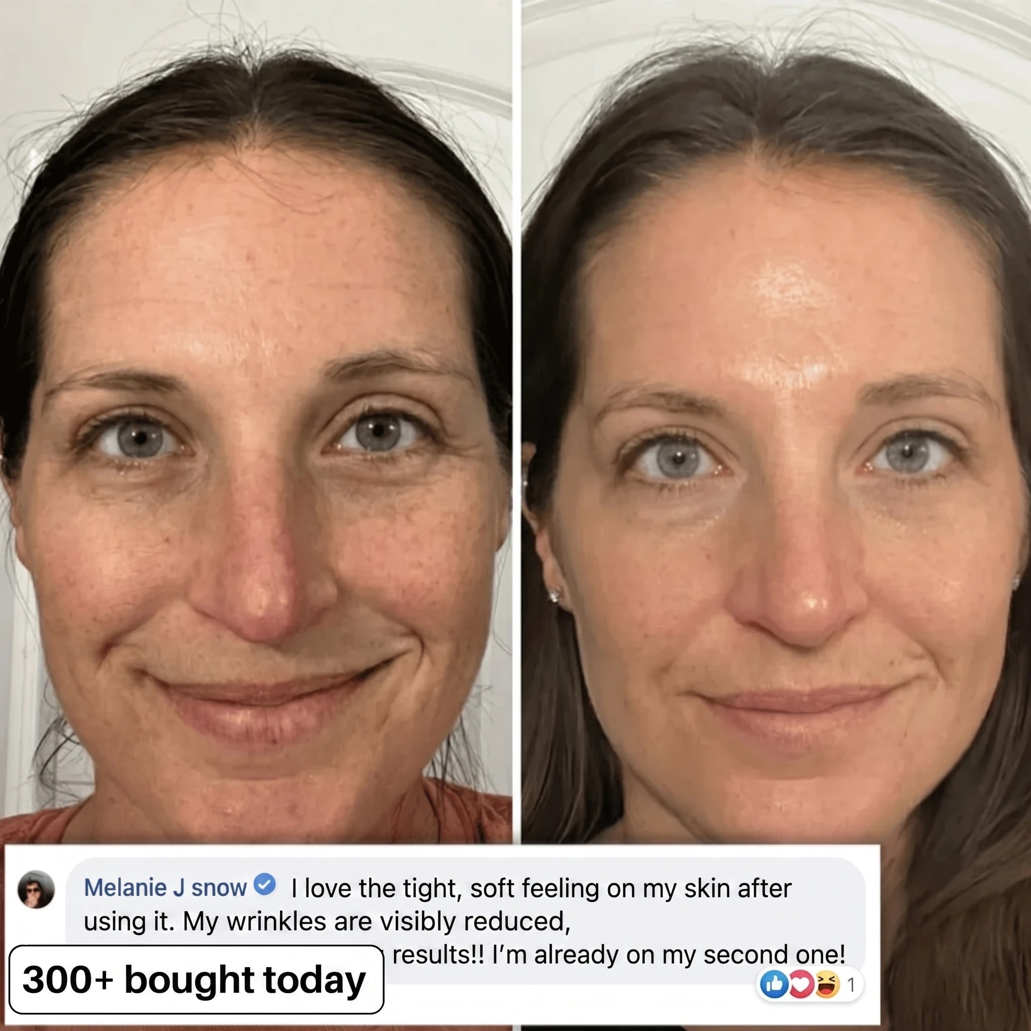 BIO-COLLAGEN PDRN PLUMPING STICK