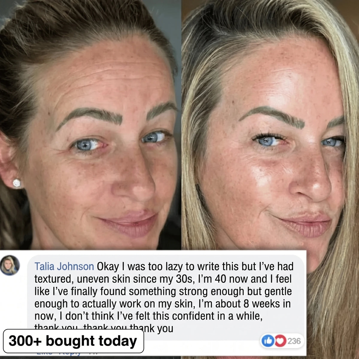 BIO-COLLAGEN PDRN PLUMPING STICK